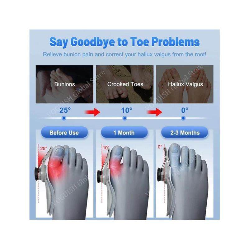 Single-piece bunion corrector splint kit with heel strap and gel toe separators