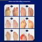 Close up of the bunion splint pivot, adjustment dial and hook-and-loop straps