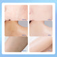 Six skin close-up photos labeled Before and After on a blue background shown with the urea cream