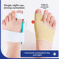 Reverse view of the bunion corrector splint showing the strap layout