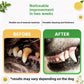 Maker before and after marketing panel showing two close up photographs of dog teeth