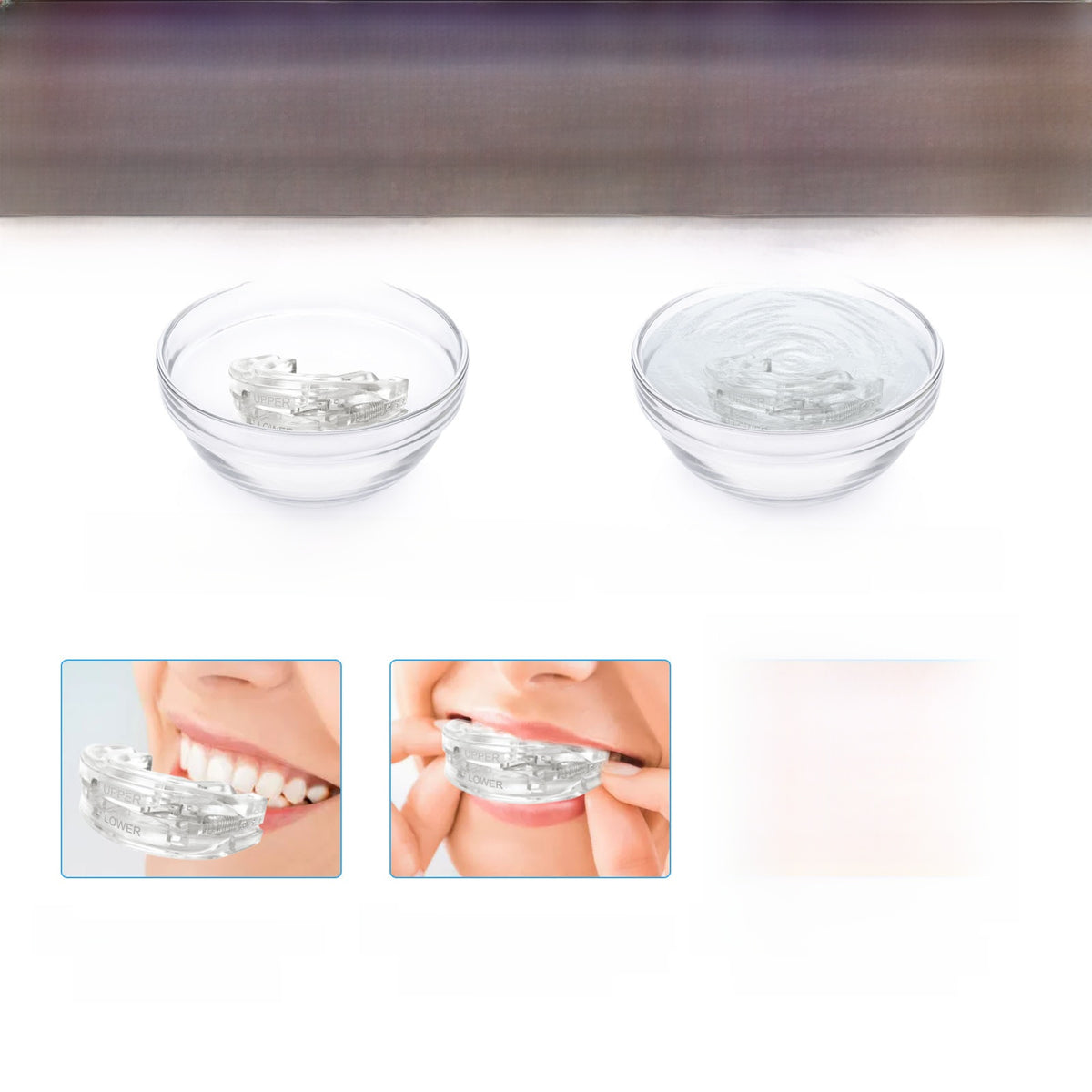 Adjustable Heat-Moldable Anti-Snoring