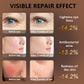 Photon Skin Rejuvenation Beauty Mask Instrument
