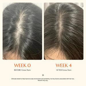 Hair Care Essence with Scalp | side profile detail