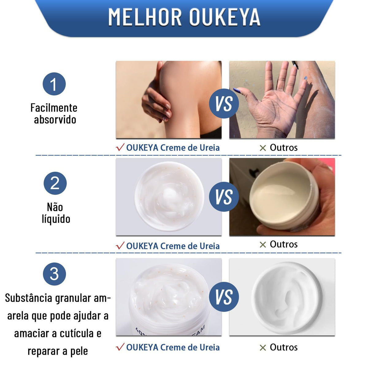 Comparison chart of the urea cream showing an easily absorbed non-greasy granular texture