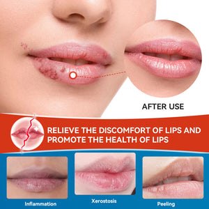Sumifun Herbal Lip Cream for Dry, Cracked and Chapped Lips 20g