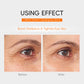 Close up of the eye area shown before and after using the Vitamin C eye serum in a comparison layout