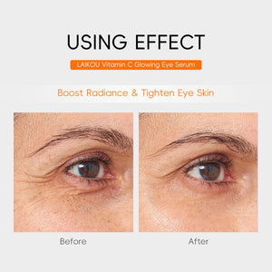 Close up of the eye area shown before and after using the Vitamin C eye serum in a comparison layout
