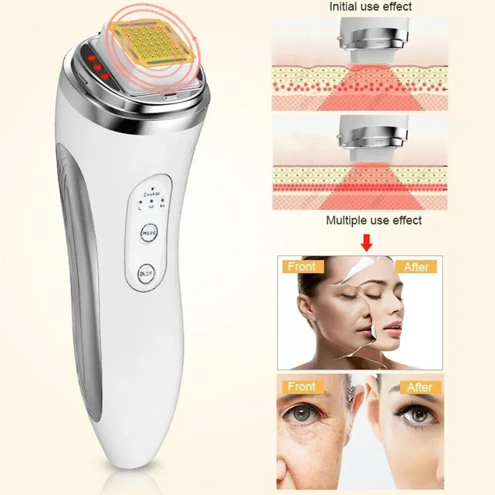 Radio frequency skin device shown in hand for scale beside the face and jawline