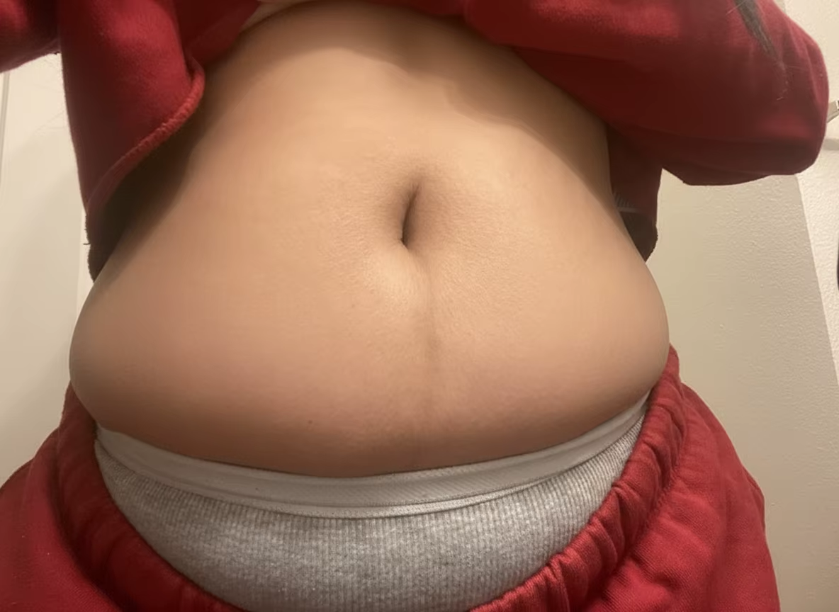 stretch-mark-cream-body-skin-repair customer review photo 10