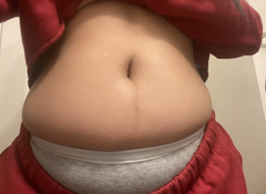 stretch-mark-cream-body-skin-repair customer review photo 10