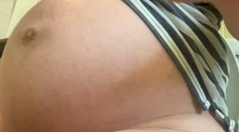 stretch-mark-cream-body-skin-repair customer review photo 11