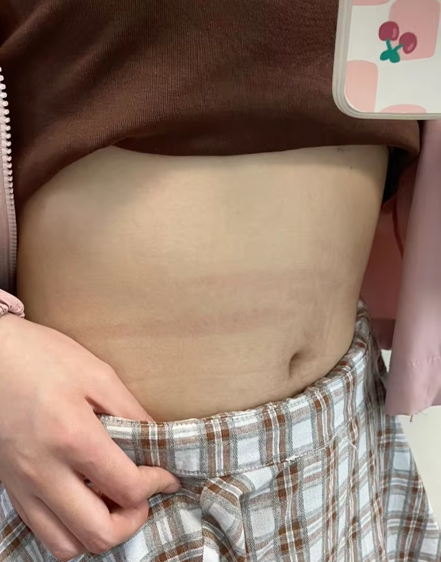 stretch-mark-cream-body-skin-repair customer review photo 14