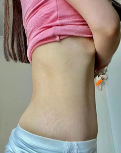 stretch-mark-cream-body-skin-repair customer review photo 16