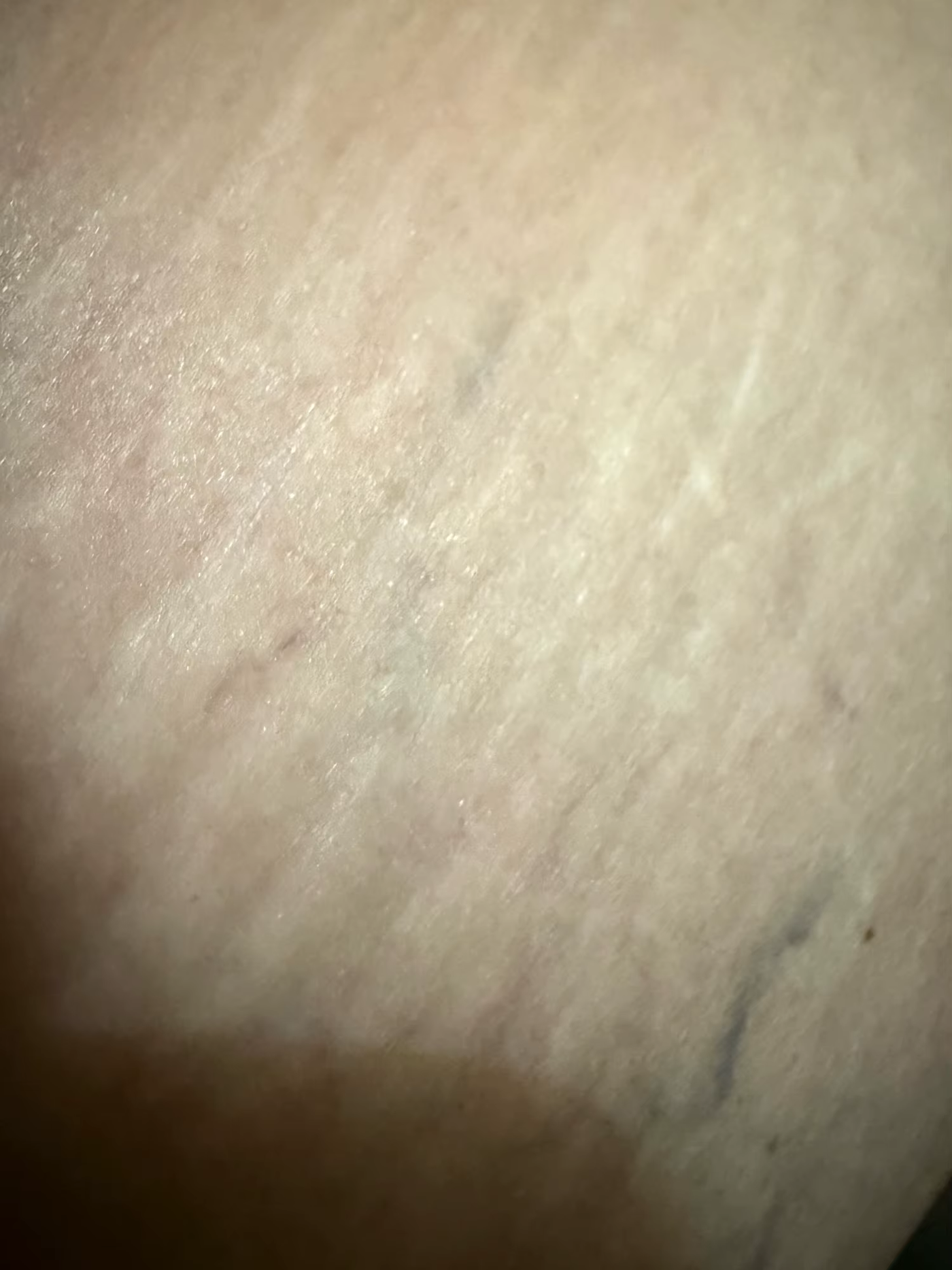 stretch-mark-cream-body-skin-repair customer review photo 17