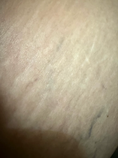 stretch-mark-cream-body-skin-repair customer review photo 17