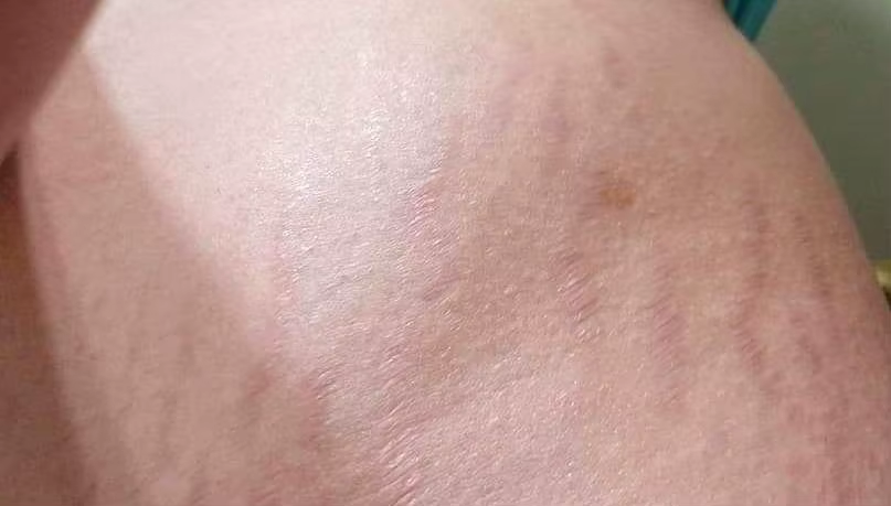 stretch-mark-cream-body-skin-repair customer review photo 19