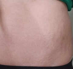 stretch-mark-cream-body-skin-repair customer review photo 19