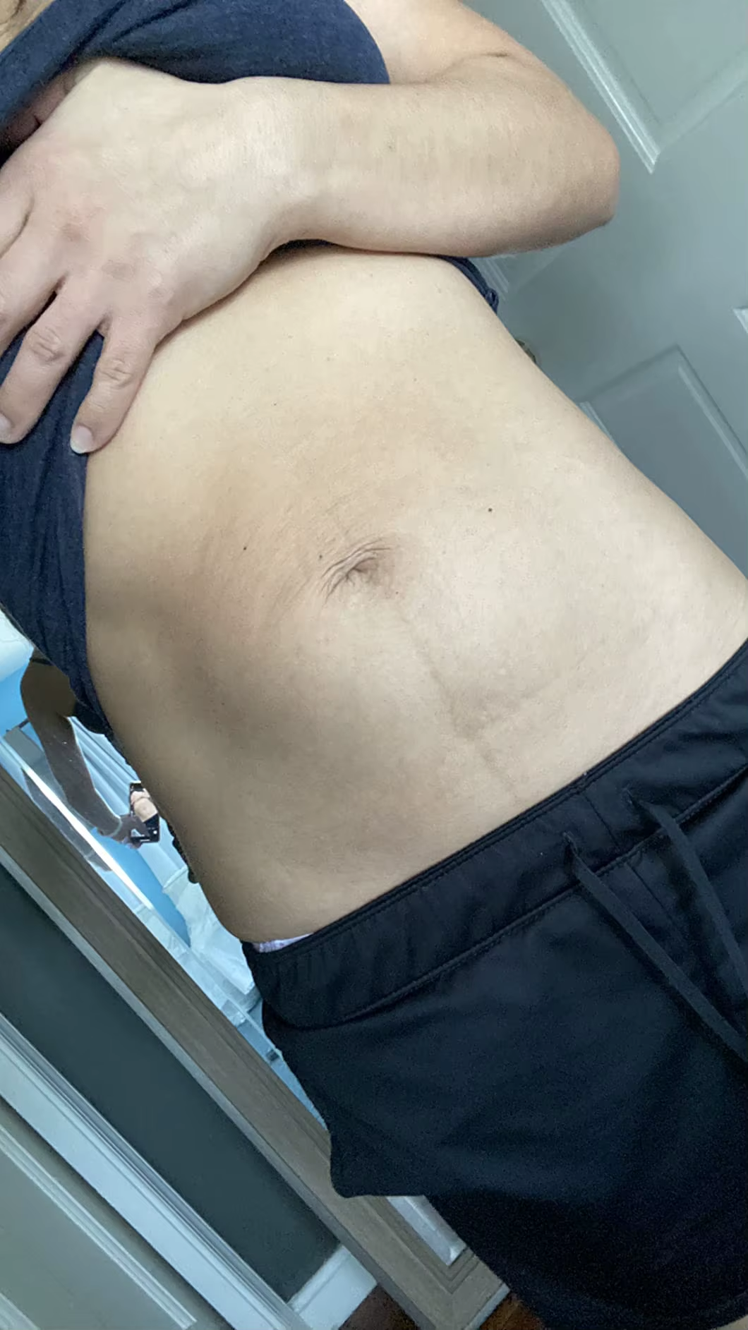 stretch-mark-cream-body-skin-repair customer review photo 2
