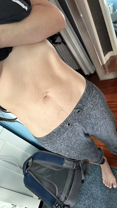 stretch-mark-cream-body-skin-repair customer review photo 2