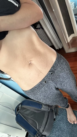 stretch-mark-cream-body-skin-repair customer review photo 2