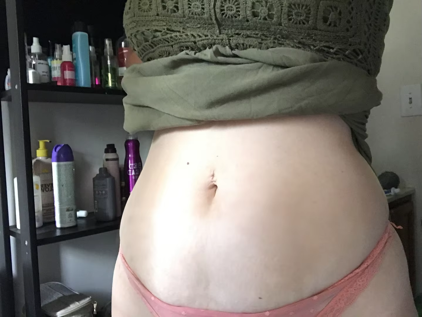 stretch-mark-cream-body-skin-repair customer review photo 4
