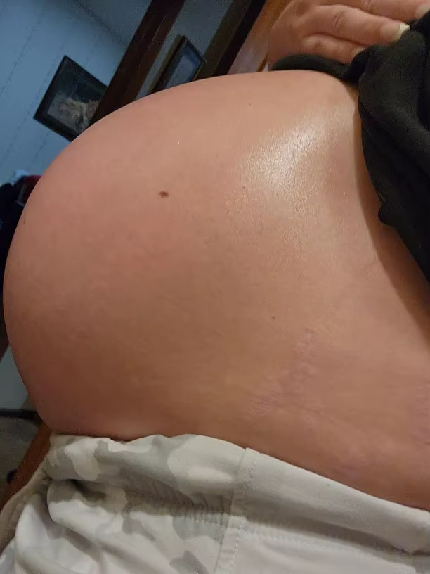 stretch-mark-cream-body-skin-repair customer review photo 5