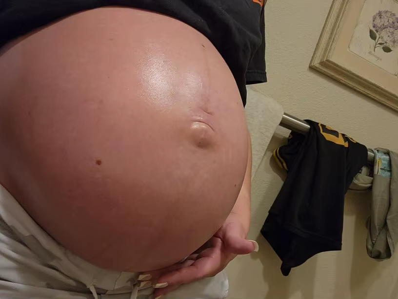stretch-mark-cream-body-skin-repair customer review photo 5