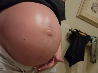 stretch-mark-cream-body-skin-repair customer review photo 5