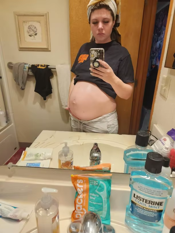 stretch-mark-cream-body-skin-repair customer review photo 5