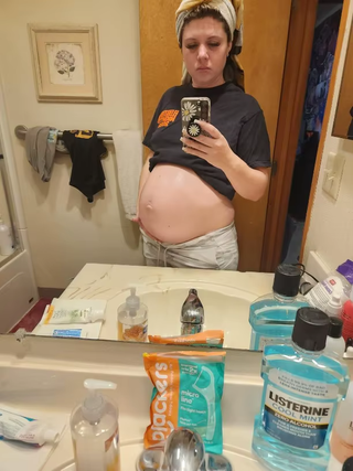stretch-mark-cream-body-skin-repair customer review photo 5