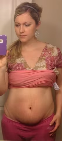 stretch-mark-cream-body-skin-repair customer review photo 6
