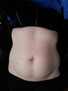 stretch-mark-cream-body-skin-repair customer review photo 7