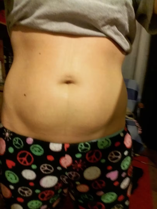 stretch-mark-cream-body-skin-repair customer review photo 7