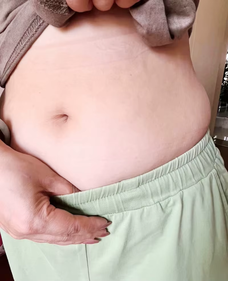 stretch-mark-cream-body-skin-repair customer review photo 8