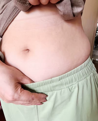 stretch-mark-cream-body-skin-repair customer review photo 8