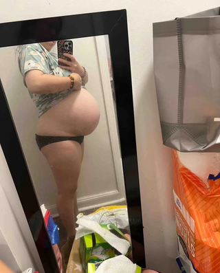 stretch-mark-cream-body-skin-repair customer review photo 9