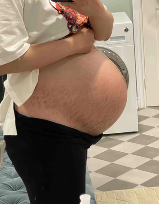 stretch-mark-cream-body-skin-repair customer review photo 9